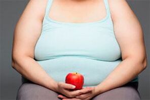 Aby wyleczyć żylaki, musisz schudnąć